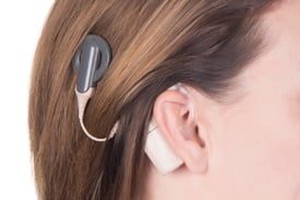 Cochlear Implant